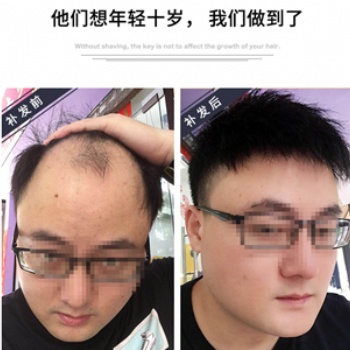 興都恒發(fā)假發(fā)定制全新升級(jí)